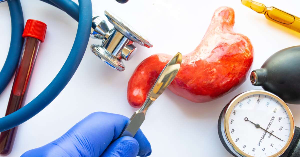 نقص الفيتامينات بعد عملية التكميم يتسبب في مضاعفات خطيرة.. احذر منها