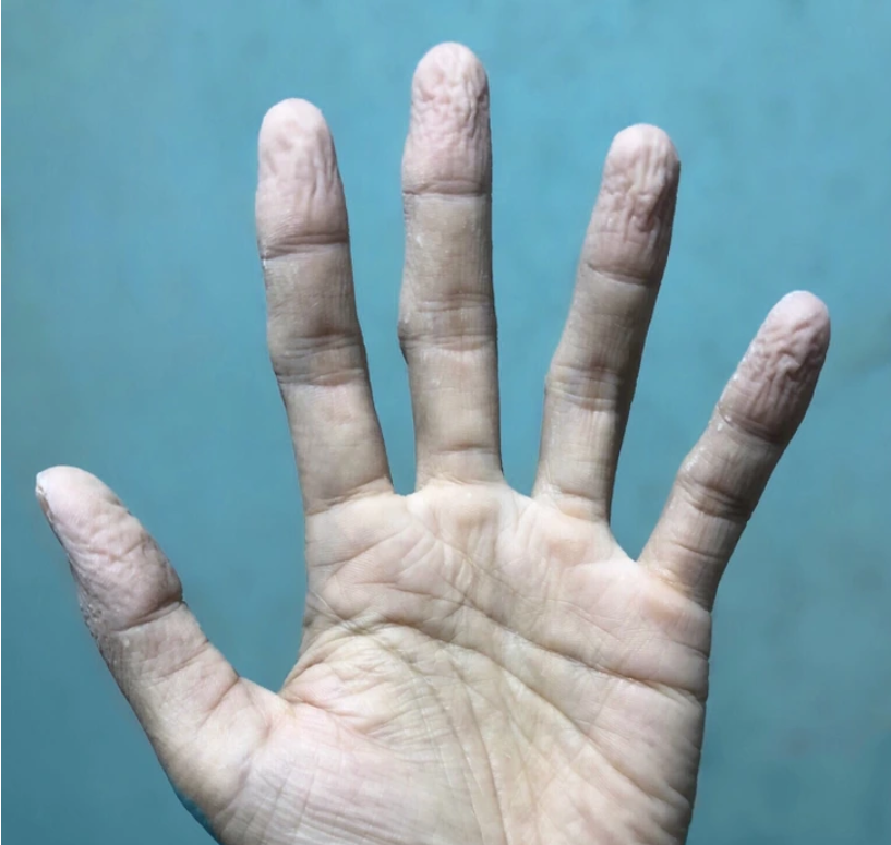 لا تتجاهل هذه العلامات التحذيرية من جسمك