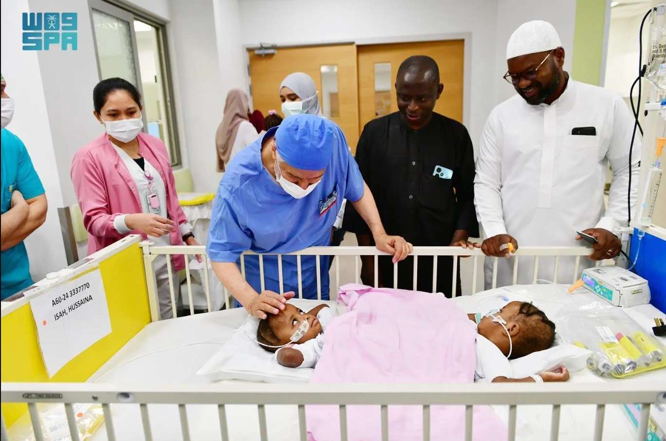 عملية فصل التوأم السيامي النيجيري 