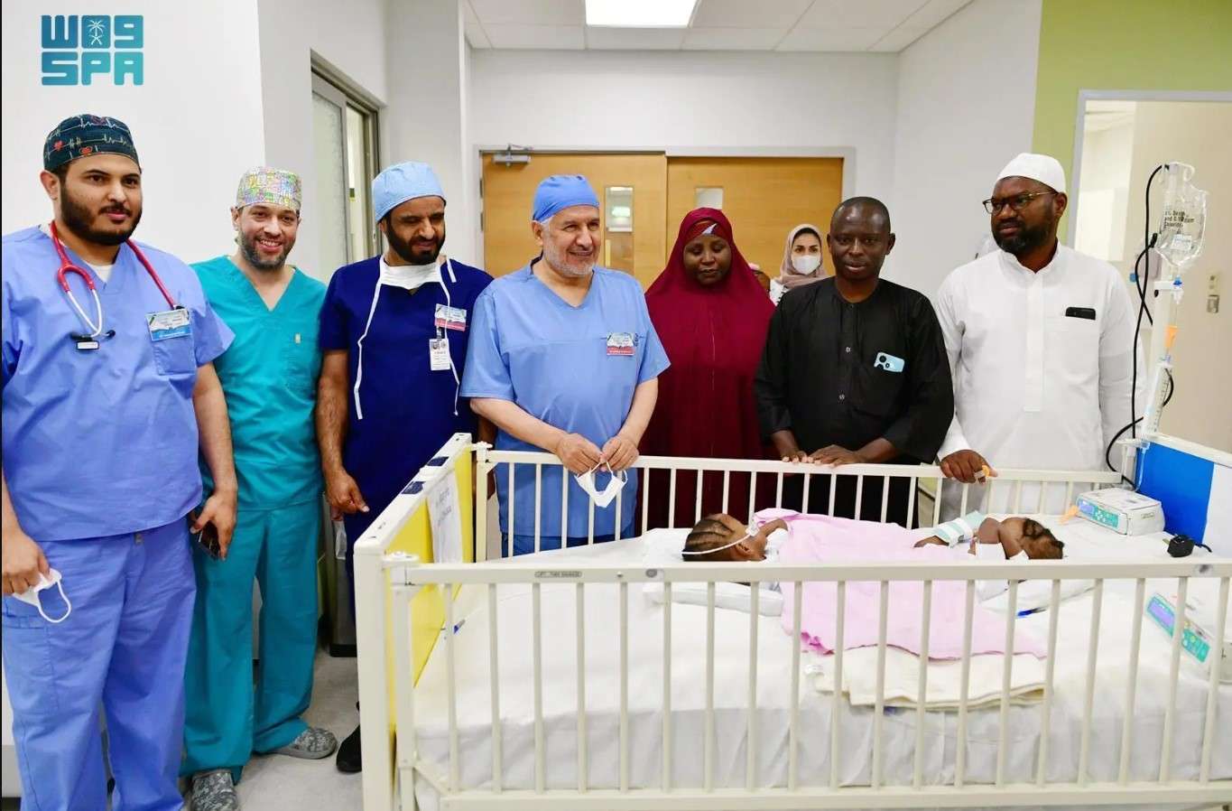 عملية فصل التوأم السيامي النيجيري 