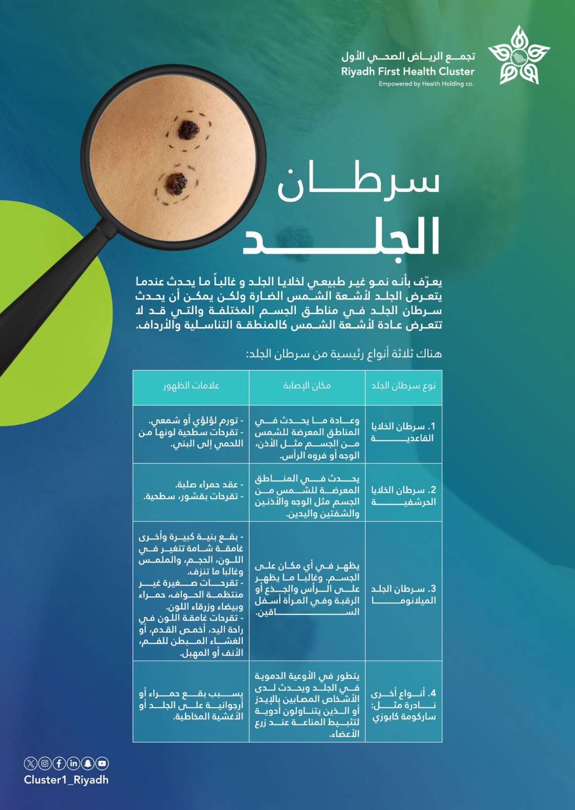 أنواع سرطان الجلد وأماكن الإصابة بها وأعراضها