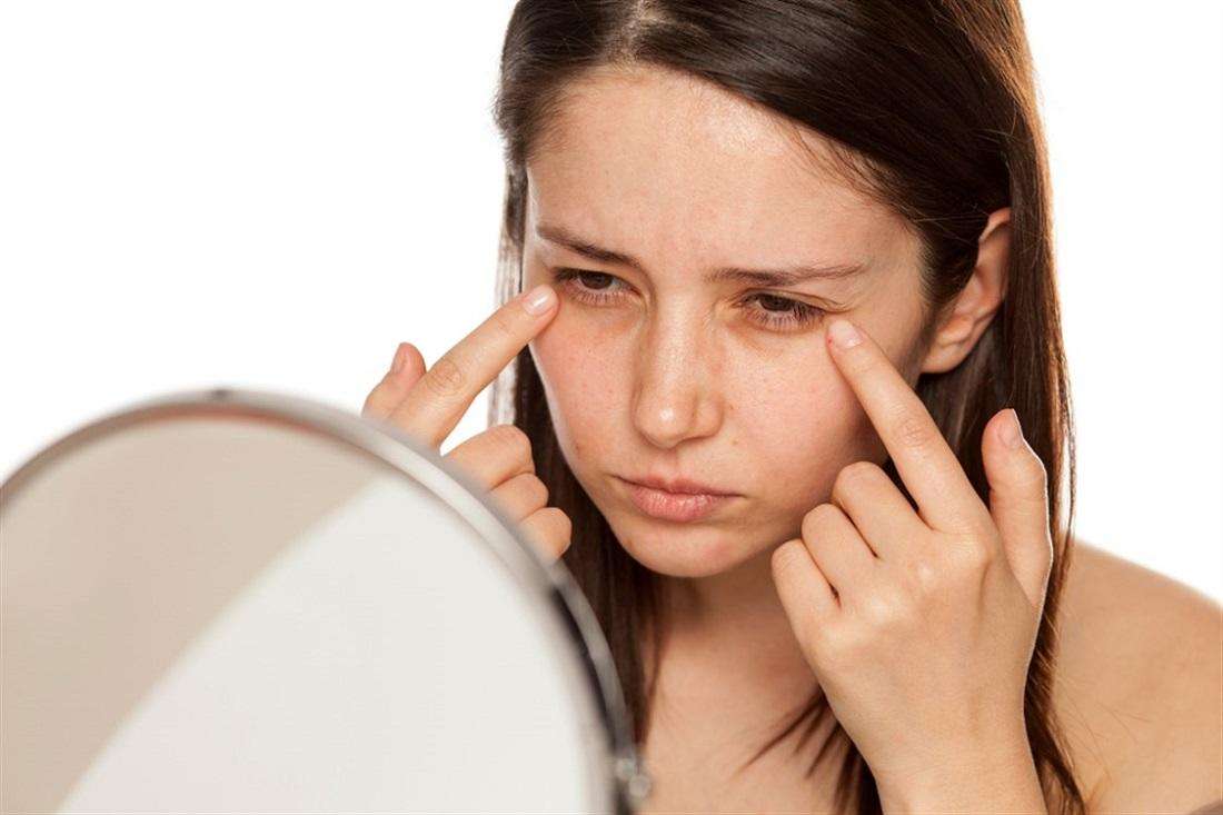 تخلصي من الهالات السوداء.. 6 وصفات سهلة